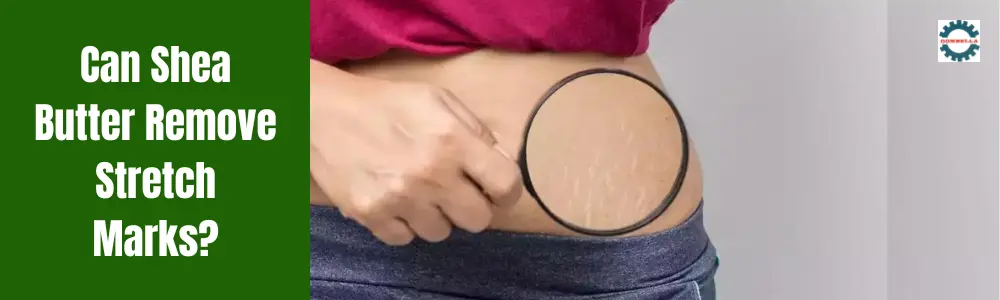 Can Shea Butter Remove Stretch Marks?